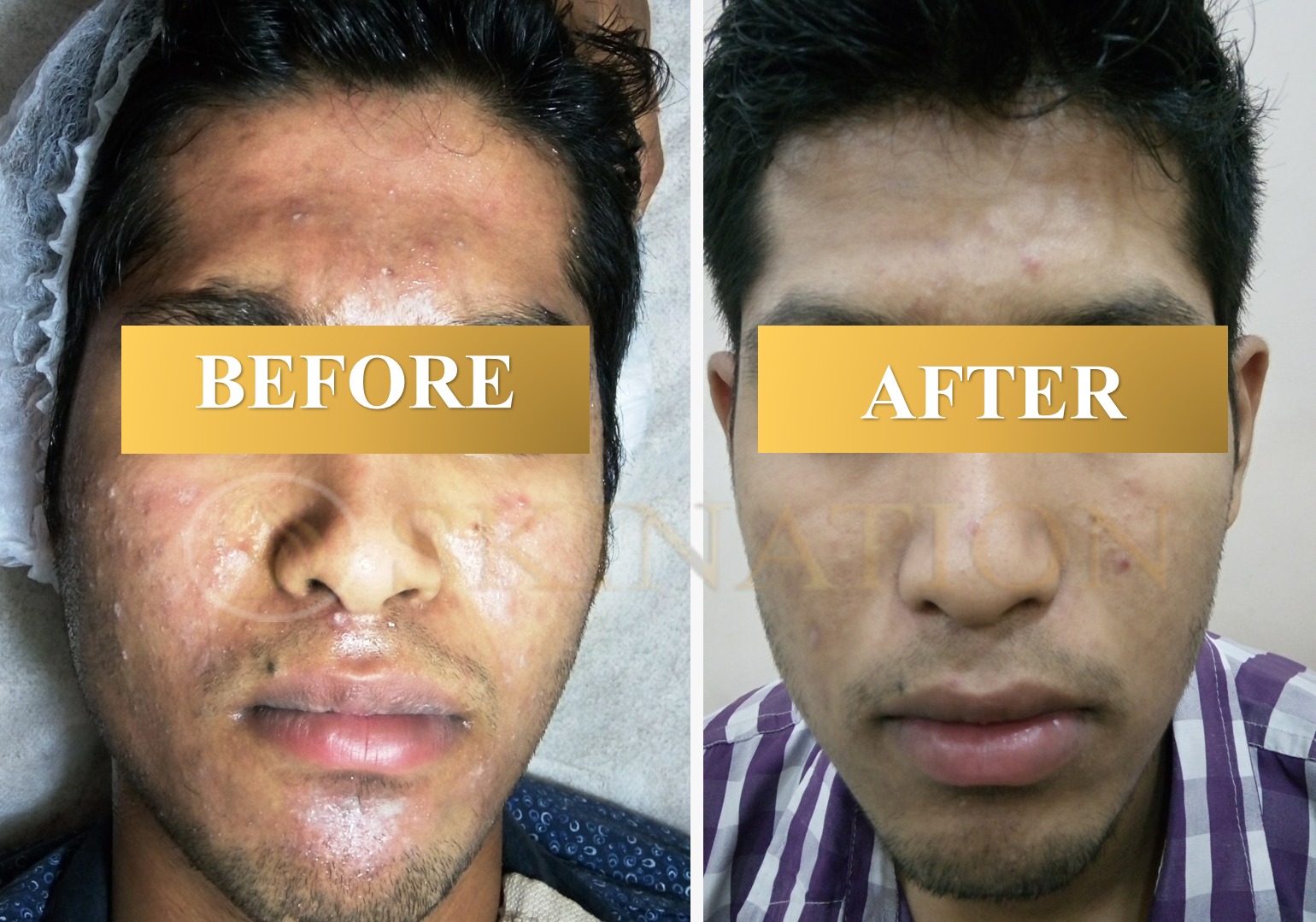 Pigmentation & Spots