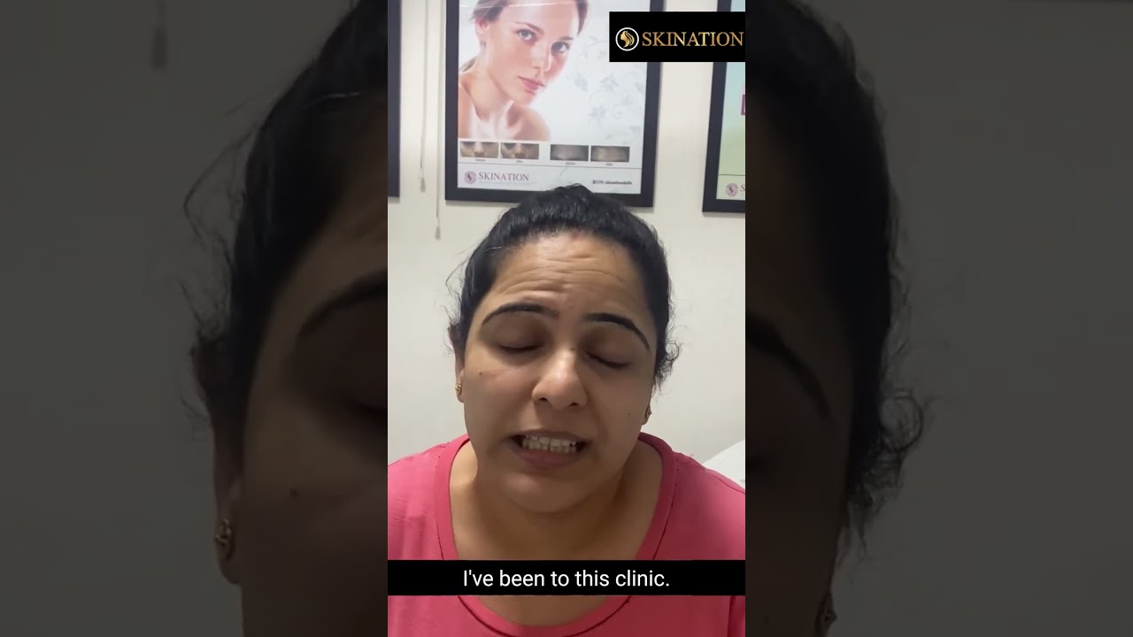 hair fall treatment with Skination Clinic