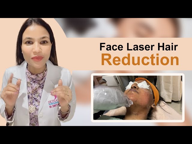 Laser Hair Reduction