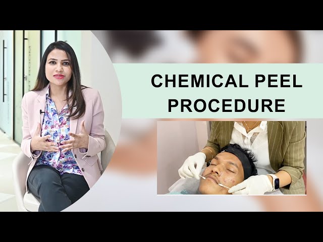 Chemical Peel Procedure